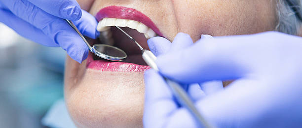 Best Chipped Tooth Repair Near Me  in Redfield, SD